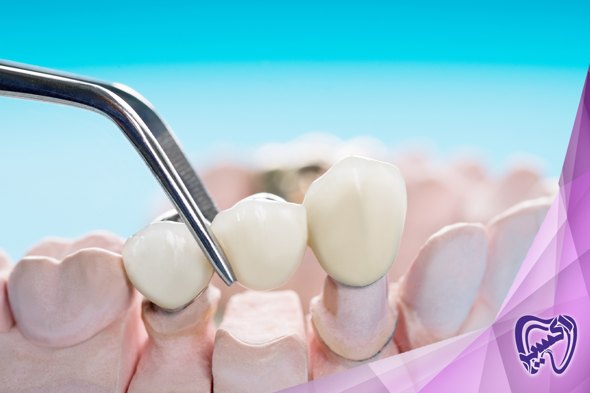 از چه سنی کودک من باید ترمیم دندان را شروع کند؟