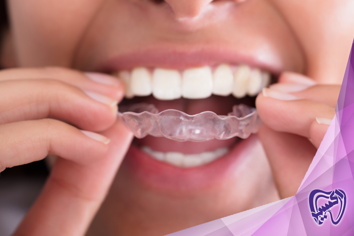 آیا دندان قروچه به طور کامل قابل درمان است؟