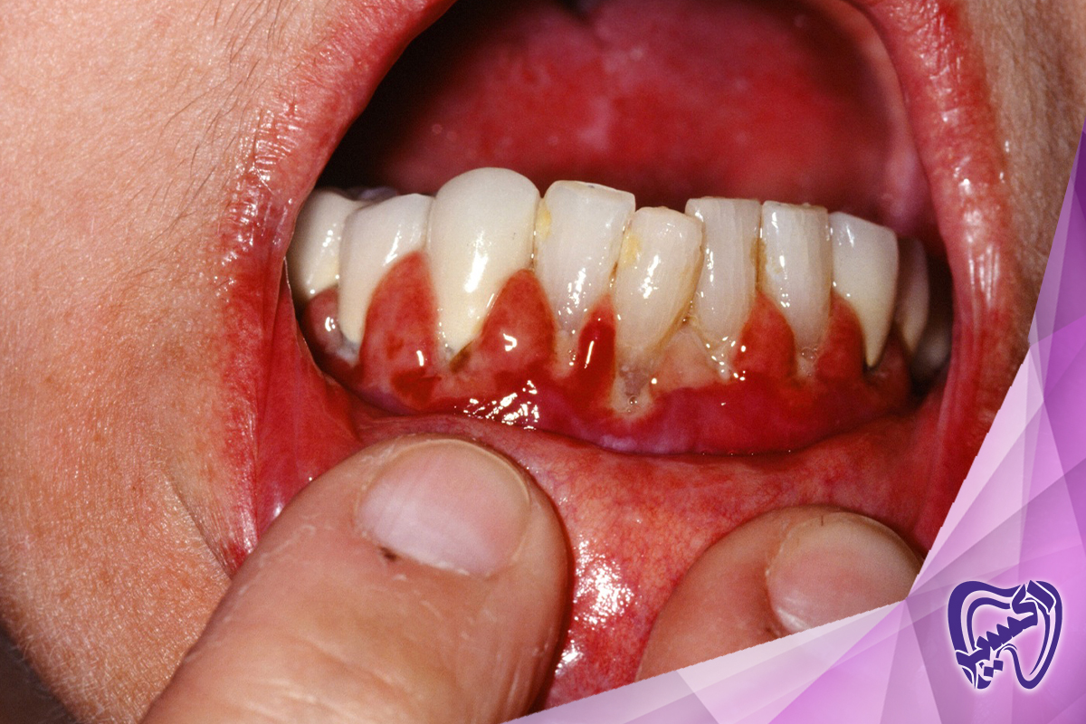 جراحی دهان و فک و صورت: رسیدگی به شرایط پیچیده