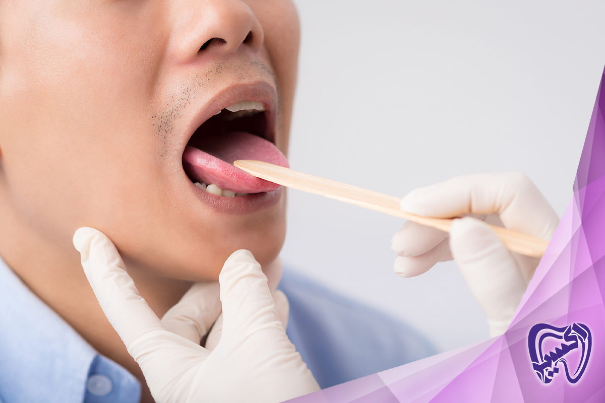 روش‌های درمانی سنتی برای سندرم سوزش دهان
