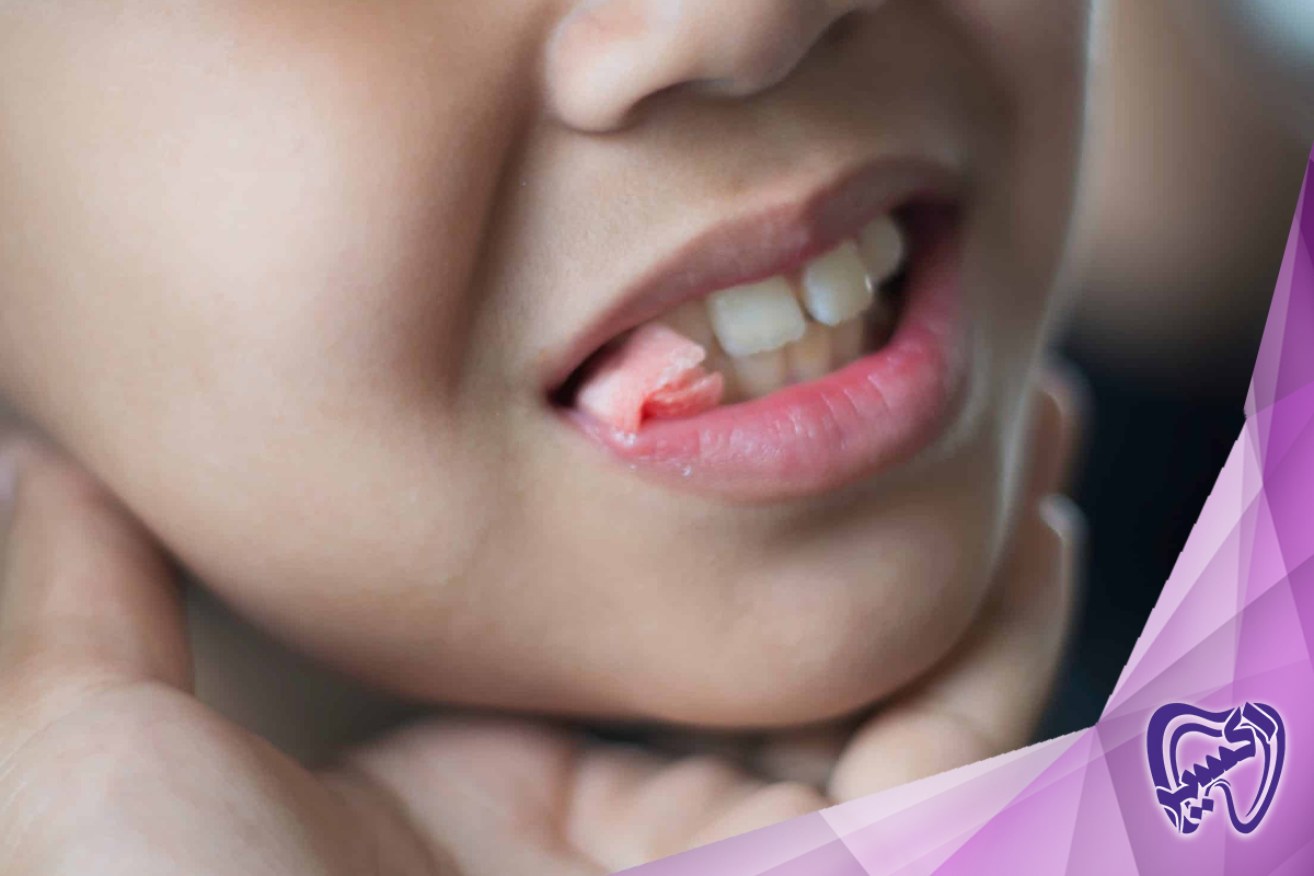 حفظ سلامت دهان پس از کشیدن دندان