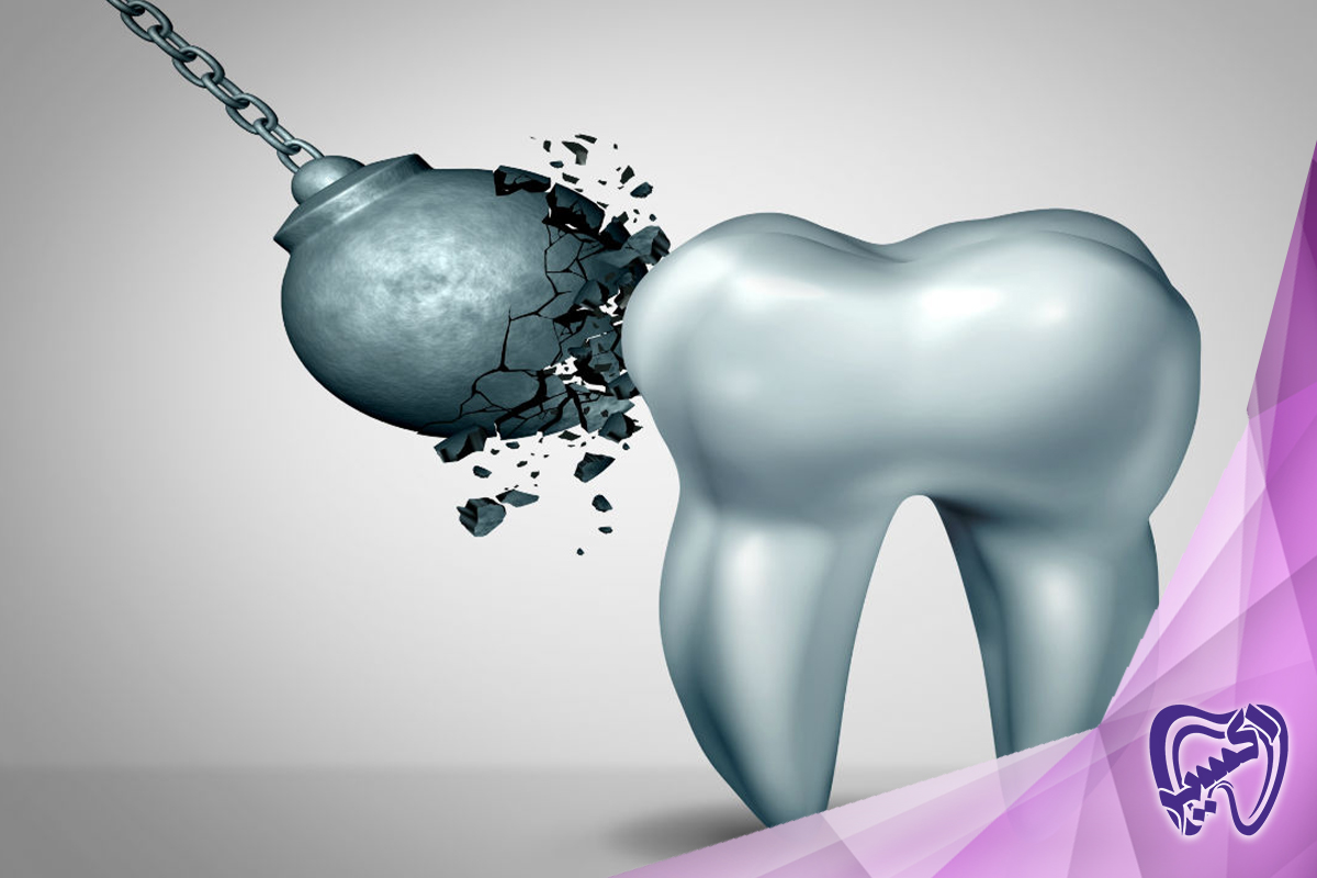 برای مراقبت و محافظت از مینای دندان خود چه اقداماتی انجام دهیم؟ ( پیشگیری در خانه)