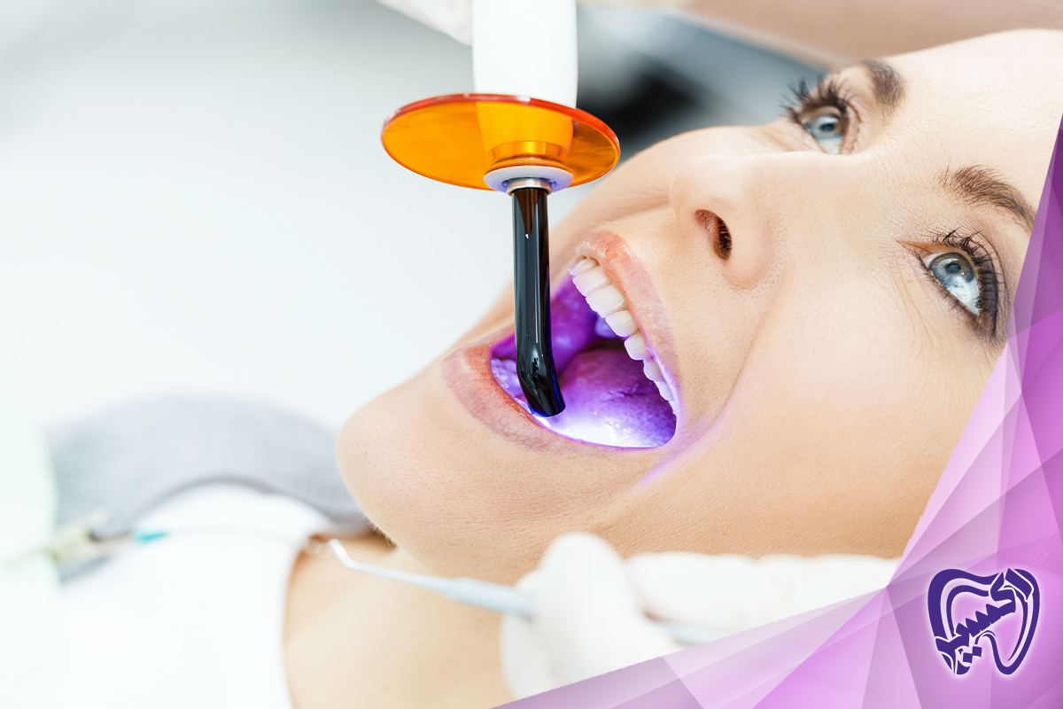 مزایای بلیچینگ دندان چیست؟