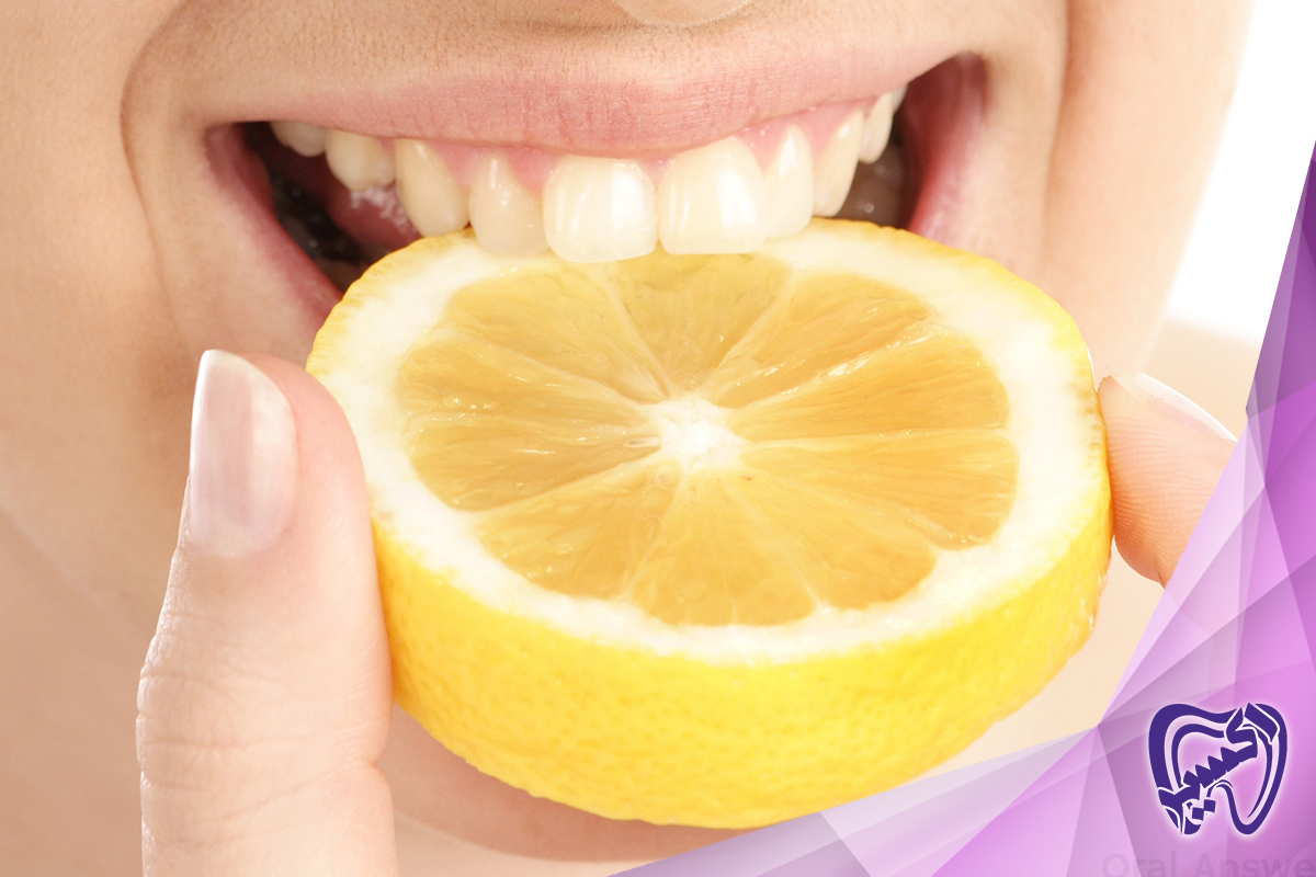 علائم فرسایش مینای دندان چیست؟