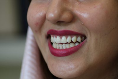 نمونه دندانپزشکی زیبایی در جنت آباد
