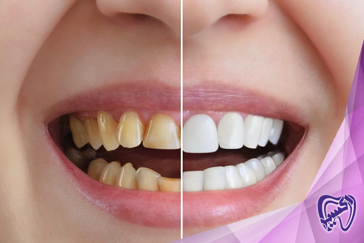 چرا دندانپزشکی زیبایی را انتخاب کنیم؟